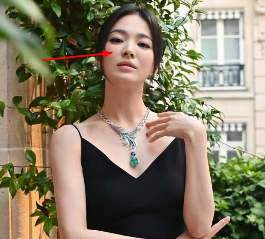 宋慧乔最新状态分析_宋慧乔脸崩原因探讨_宋慧乔